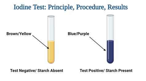 iodine test for glycogen results|Iodine Test: Definition, Objective, Principle, Procedure, Results.